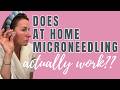 At Home Microneedling for Women Over 40 — Seranova Step by Step Tutorial