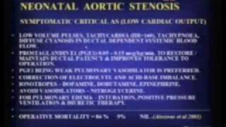 Acyanotic Congenital Heart Disease (Obstructive Lesions)