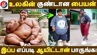 உலகின் குண்டான பையன் இப்ப எப்படி ஆயிட்டான் பாருங்க! | Tamil News | Latest News | Tamil Seithigal