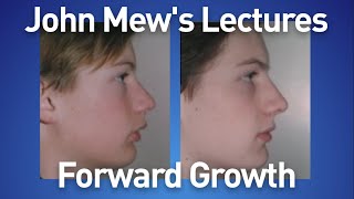 John Mew's lectures part 19: Forward Growth