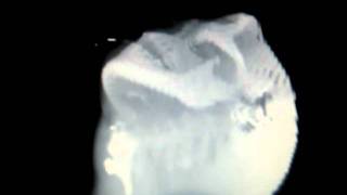 VTK Human Head Visualization 1