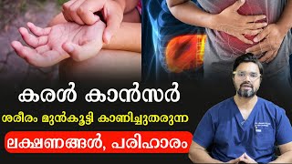 കരളിൽ കാൻസർ ശരീരം കാണിക്കുന്ന ലക്ഷണങ്ങൾ പരിഹാരം /Dr. Jassim Koya /Baiju's Vlogs