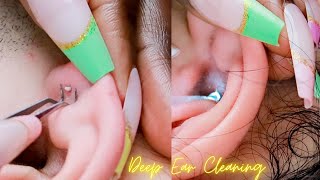 ASMR| Rare Deep Ear Cleaning \u0026 Picking ALL-ZOOMED ~ soft whispers 😴