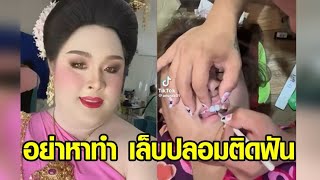 สาวประกวดธิดาช้าง ใช้เล็บปลอมติดกาวแปะฟัน แจงฟอกสีฟันไม่ทัน เตือนคนอื่นอย่าหาทำตาม