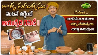 కాళ్ళ పగుళ్ళను తగ్గించే ఖర్చులేని హోమ్ రెమెడీ | Treat Cracked Heels at Home | Dr.Ravivarma Official