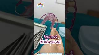 รีเทนเนอร์หิ้วฟันปลอม | คลินิกทันตกรรมฟ้าใส | จัดฟันระยอง