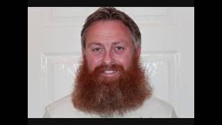 Beard Grow 281 Days Gary Daly