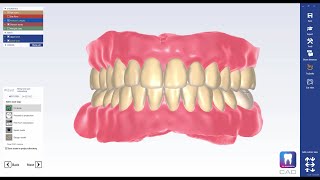 How to design full dentures in Planmeca PlanCAD® Premium