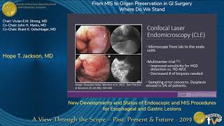 New Developments and Status of Endoscopic and MIS Procedures for Esophageal and Gastric Lesions