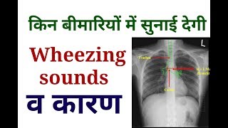 Wheezing Sounds  |   Causes OF wheezing Sounds  |  Lungs Examination