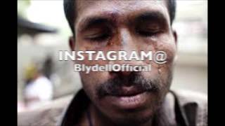 Blydell - Damage Is Done [Explicit]