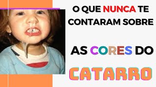 Sinusite com CATARRO AMARELO E VERDE é sempre tratamento com antibiotico? Otorrino em Curitiba