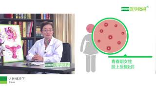 多囊卵巢綜合徵都有哪些症狀？What are the symptoms of polycystic ovary syndrome?