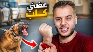 قصص الطفوله - عضني كلب بسبب حركة غبية !