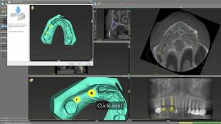 TRX coDiagnostiX Workflow | matrix® Digital Academy