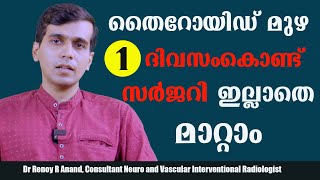 തൈറോയിഡ് മുഴ ഒരൊറ്റ ദിവസംകൊണ്ട് സർജറി ഇല്ലാതെ മാറ്റാം /Dr Renoy R Anand