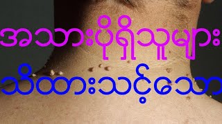 အသားပိုနဲ့ အိမ်တွင်းကုထုံးများ