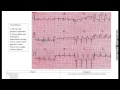 شرح ECG د.محمود سويلم