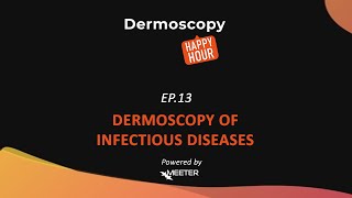 Dermoscopy Happy Hour - SEASON 2 EPISODE 13 \