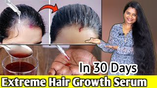 OMG..😱 உங்க முடி பாதியில் உடைஞ்சு விழுதா..? DIY Baldness Hair growth & Hair fall control Serum