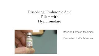 Reversing and Dissolving Dermal  hyaluronic acid filler with Hyaluronidase