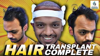 Hair Transplant in indore | Best Results \u0026 Cost of Hair Transplant in indore