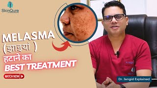 Best Treatment for Melasma | Laser Treatment for Melasma in Delhi | SkinQure | Dr. Jangid