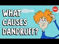 What causes dandruff, and how do you get rid of it? - Thomas L. Dawson
