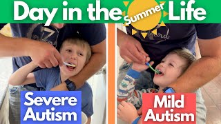 Day in the Life | Severe Autism & Mild Autism