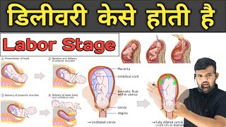 डिलीवरी केसे होती है | Labor Stage | Pregnancy | Medicine | Treatment | Hospital Knowledge | Doctor