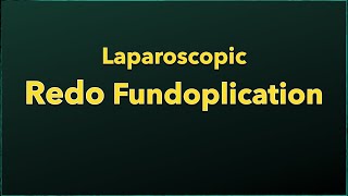 8. Laparoscopic Redo Fundoplication