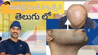 Hair Transplant In Hyderabad |Best Surgeon Results & Clinic Of Hair Transplant Surgery In Hyderabad