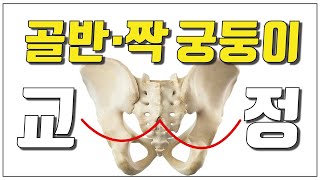 골반 통증, 골반 교정, 짝궁둥이를 한번에 잡을수 있다고? 골반틀어짐 이유, 엉덩이 통증, 골반통증 교정 방법