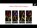 Speckle Tracking-Basics Evaluation