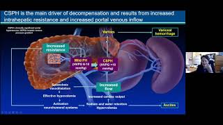 Grand Rounds 2021.02.17