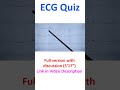 ECG Quiz