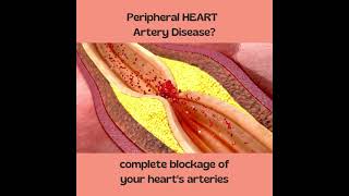 Complete Heart Blockage - Symptoms of Heart Attack
