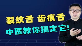 裂纹舌、齿痕舌、舌苔厚都是怎么回事？中医教你搞定它！