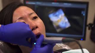 Caso practico con Formlabs Dental 3D del Dr Michael Scherer