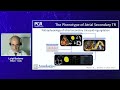 imaging essentials in atrial secondary tricuspid regurgitation webinar