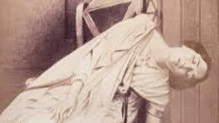 Top 10 Unsettling True Facts About The Victorian Era