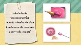 VTR การเตรียมตัวสำหรับผู้ป่วย colposcopy