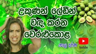 උකුණු වදයට අත් බෙහෙතක්  #Lice # Sinhala