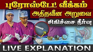 பெரிதான புரோஸ்டேட் சுரப்பியை அதிநவீனஅறுவை சிகிச்சையில் தீர்வு  | Dr.Jeevagan Murugesan  | Prostate