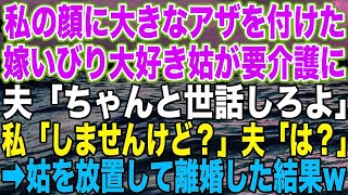 【スカッとする話】私の顔に大きなアザを付けた、嫁いびり大好き姑が要介護に。夫「ちゃんと世話しろよ」私「しませんけど？」夫「は？」➡︎姑を放置して離婚した結果w【修羅場】