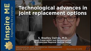 Technological Advances in Joint Replacement Options