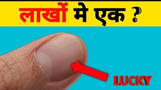 लाखों में एक 😱। दुनिया में केवल 1% लोगों को होता है। Mind blowing facts. Facts about human.