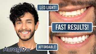 Whiter Teeth in JUST A WEEK! | NEW AuraGlow Teeth Whitening Updated Kit