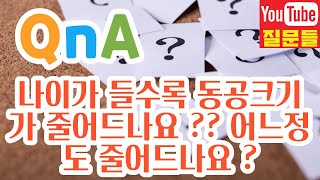 나이가 들수록 동공크기가 줄어드나요 ?? 어느정도 줄어드나요 ?