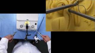 Laparoscopic Suturing Running Suture